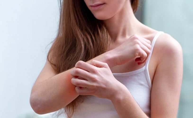Woman experiencing allergic reaction to Cymbalta.