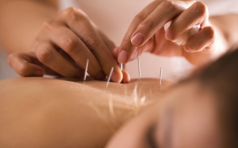Doctor sticking needles into girl's body.