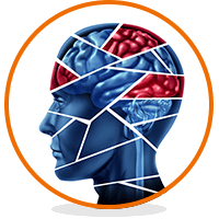 Droopy Eyelid is one of the symptoms of alcoholic wet brain syndrome.