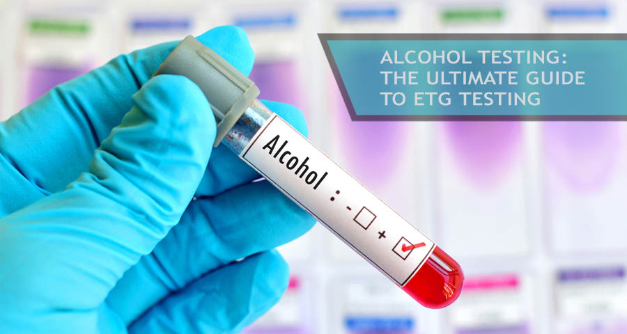 EtG Test & Calculator for Alcohol Detection