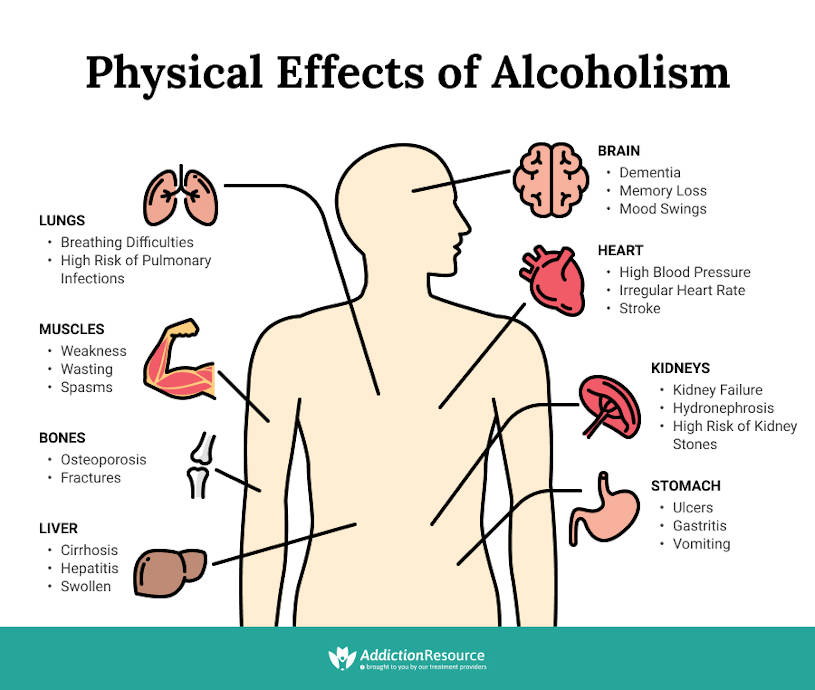Physical effects of alcoholism on the body.